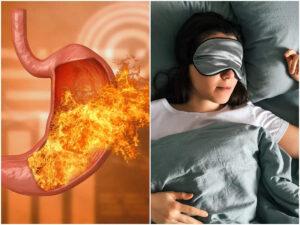 Acid Reflux - Adjustable Bed Benefits